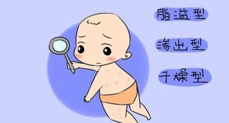 杏璞霜为你细说 婴儿湿疹的三种类型
